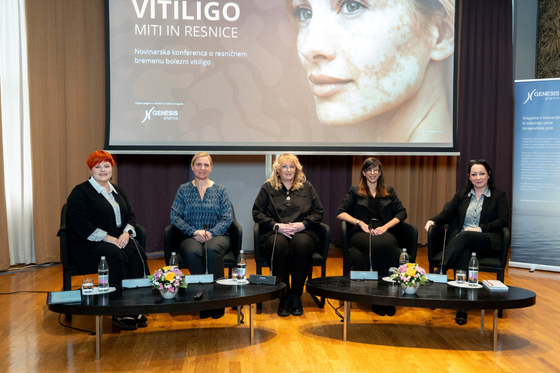 Vitiligo ni le kožna bolezen, temveč globlja izkušnja